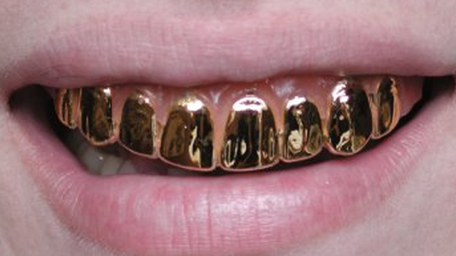 Złote zęby uratują Ci życie